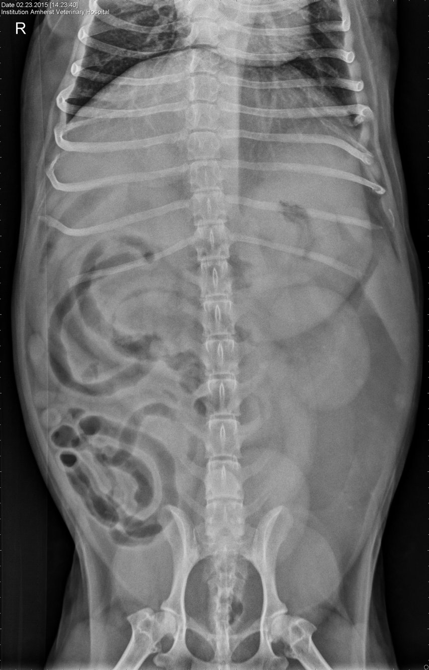 Case Of The Week  Not All Abdominal Masses Are Bad